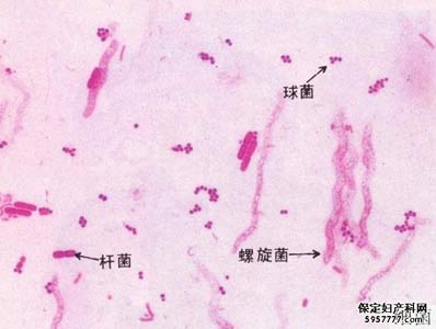 抚州治疗阴道炎医院